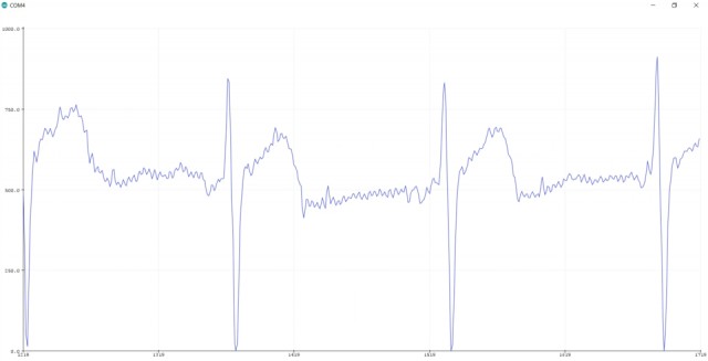 ECG Signal