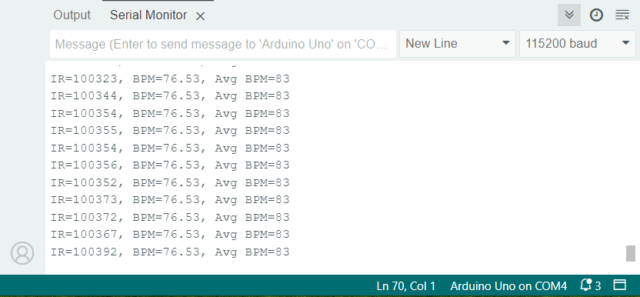 MAX30102 Heart Rate Arduino